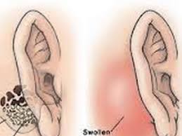 belakang telinga 1